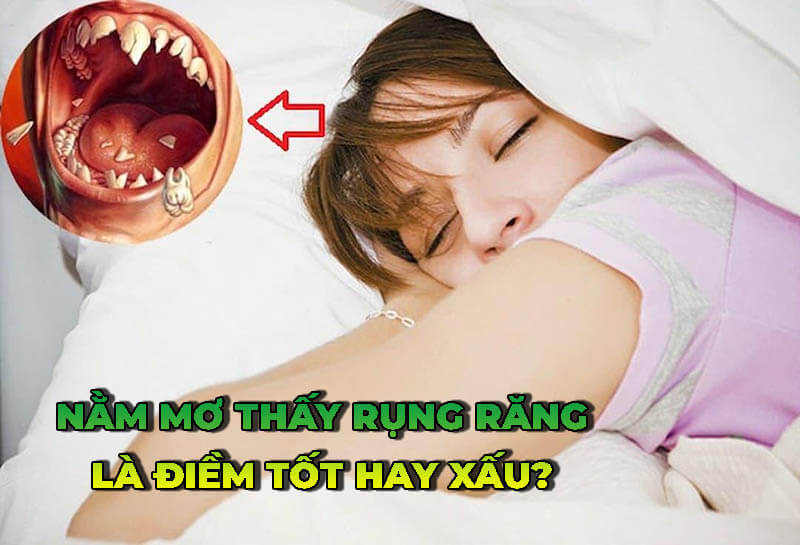 Nằm mơ thấy rụng răng đã không còn là điều gì quá bất ngờ